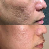 MaceoCandida review photo