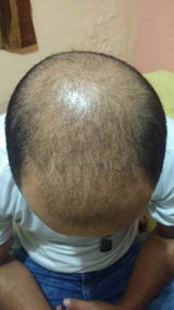 Plinio Freitas review photo