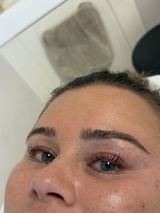 Anonyme review photo