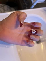Anonymous review photo