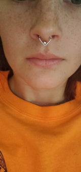 Tabby review photo