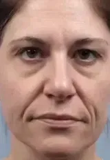 A***r review photo