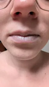 Anonymous review photo