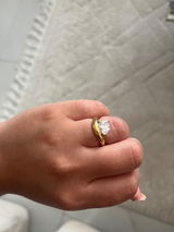 Anonym review photo