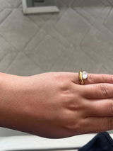 Anonym review photo