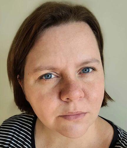 Customer photo wearing Love Story Dopamine Colored Contact Lenses