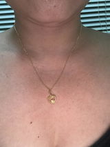 Anonymous review photo