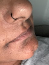 Anonymous review photo