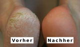 Hirnhaut review photo