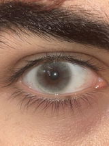 E**. review photo