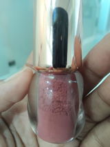 Anonymous review photo