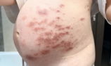 Anonymous review photo
