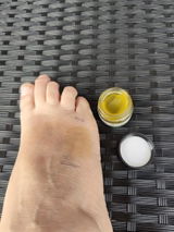 Anonymous review photo