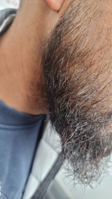 Mchothia review photo