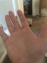 Anonymous review photo