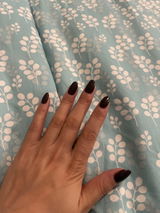 Anonymous review photo