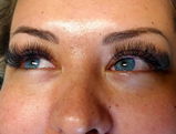 @alloutbeautyadl review photo