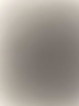 Anonyme review photo