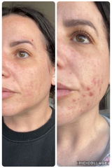 Larissa review photo