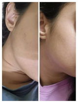 Pranee review photo