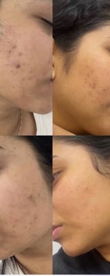 shaa review photo