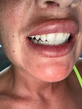 Deutlich heller als zuvor , schon nach der ersten Anwendung review photo