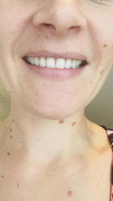 Zahnbleaching für Zuhause review photo