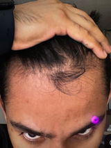 Anonymous review photo