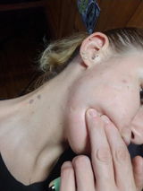 Mickenzie review photo
