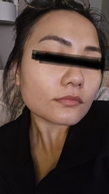 BL.91 review photo