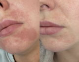 Am J. review photo