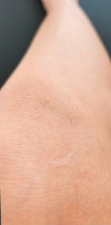 Emilija K. review photo