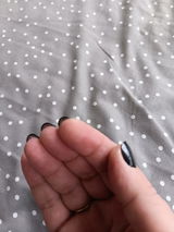 Anonym review photo