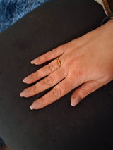 Anonym review photo