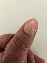 Anonym review photo