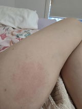 Anonymous review photo