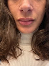 Alexis review photo