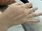 Anonymous review photo