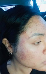 Nidia Almanza review photo