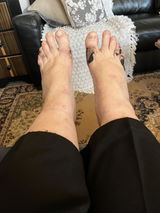 Anonymous review photo