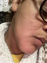 Anonymous review photo