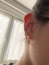 Anonyme review photo