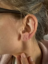 Anonyme review photo