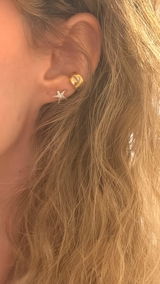 Anonyme review photo