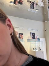 Anonyme review photo