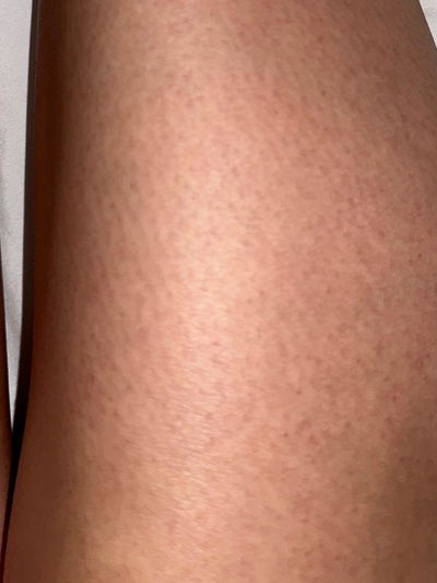 Review photo from Sofia A., verified buyer of Bare Oil cyperus rotundus oil, legs
