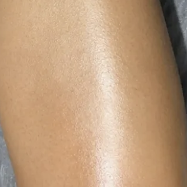 Cyperus rotundus oil customer photo: smooth legs, shared with her review (Rachel S., verified buyer of nellaskin Bare Oil)