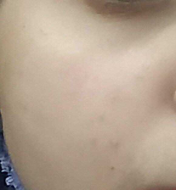 Moisturizer (Occlusive)