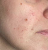 Aline review photo