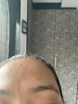 Anonymous review photo